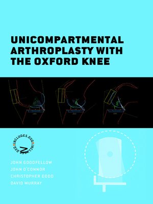 cover image of Unicompartmental Arthroplasty with the Oxford Knee